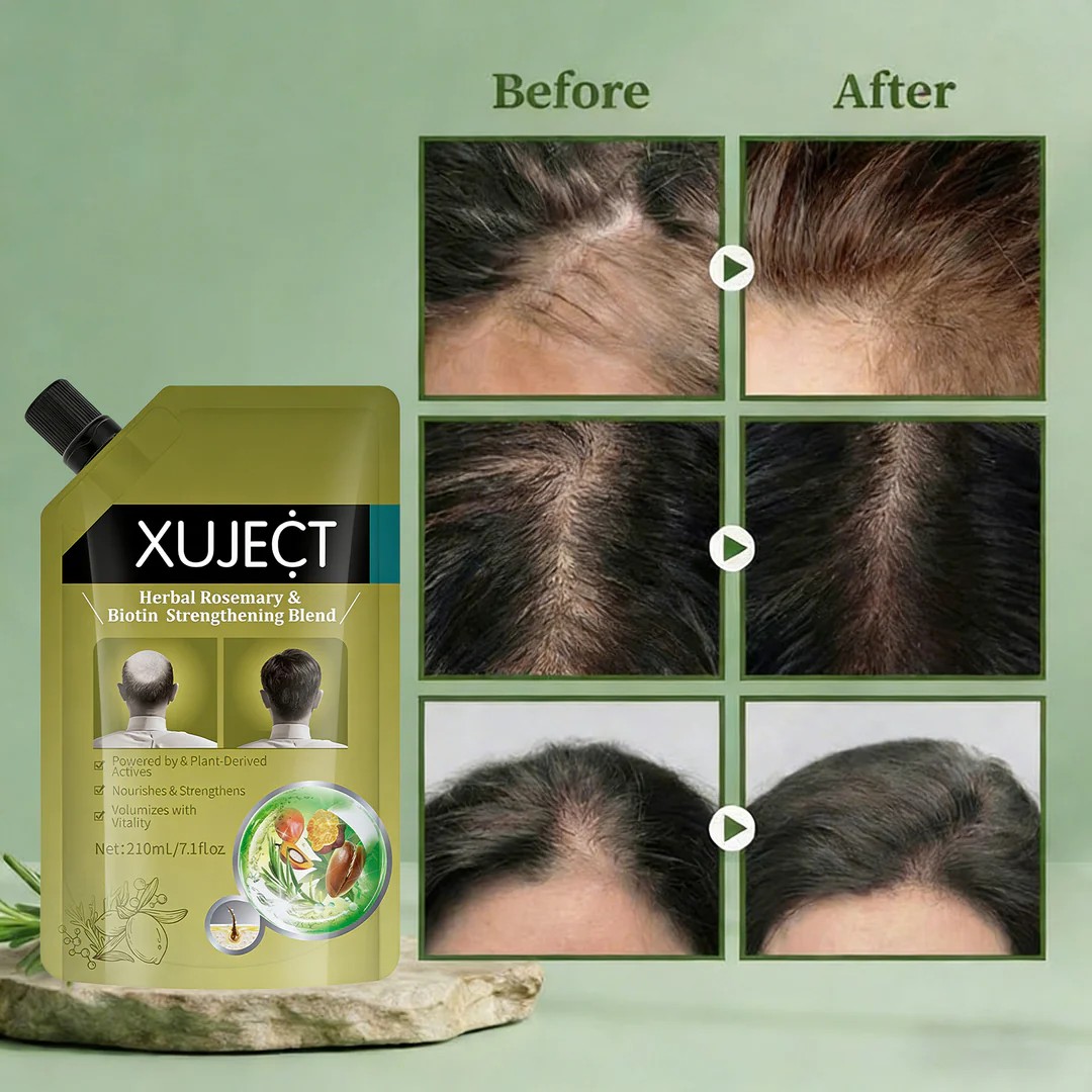 【Rosmarin-Keratin-Volumenshampoo】✨Sichtbare Ergebnisse in 2 Wochen bei starkem Haarausfall✨Dichtes Haar wie in jungen Jahren – durch dauerhafte Anwendungp✨