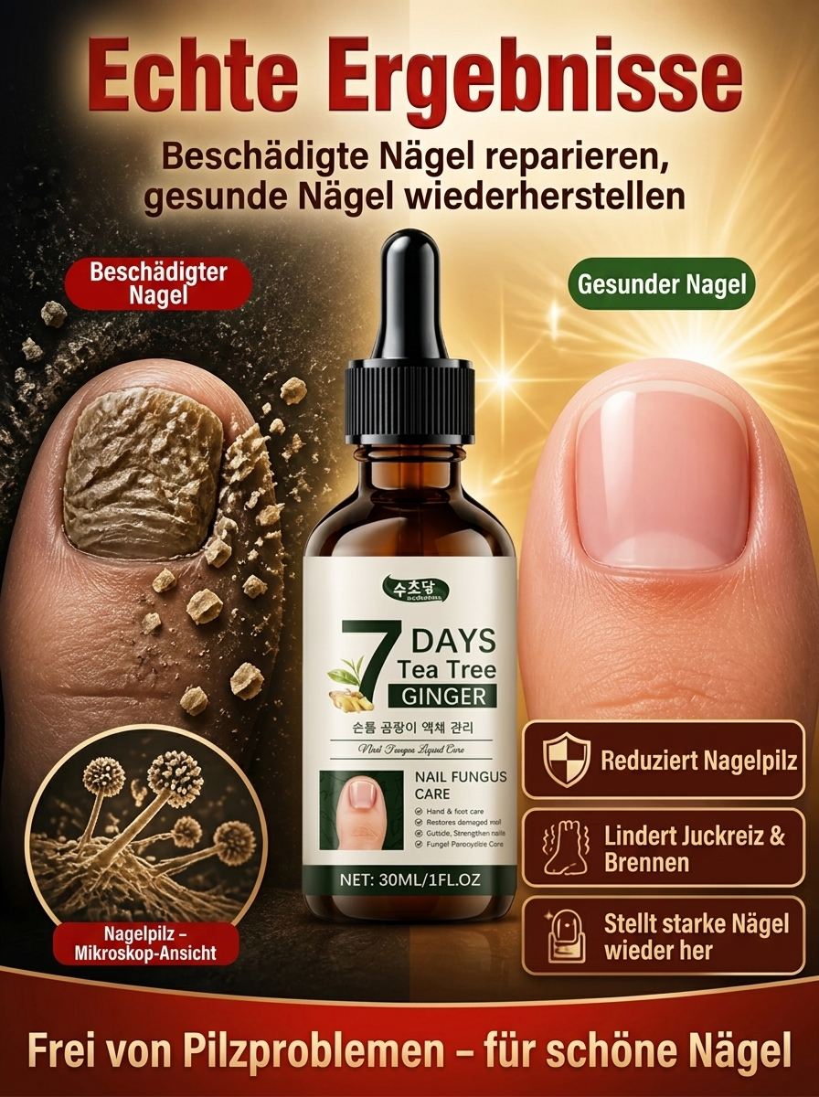 【Nagelpflegelösung 】Dringt tief in die Nägel ein und bekämpft Nagelpilz an der Wurzel.