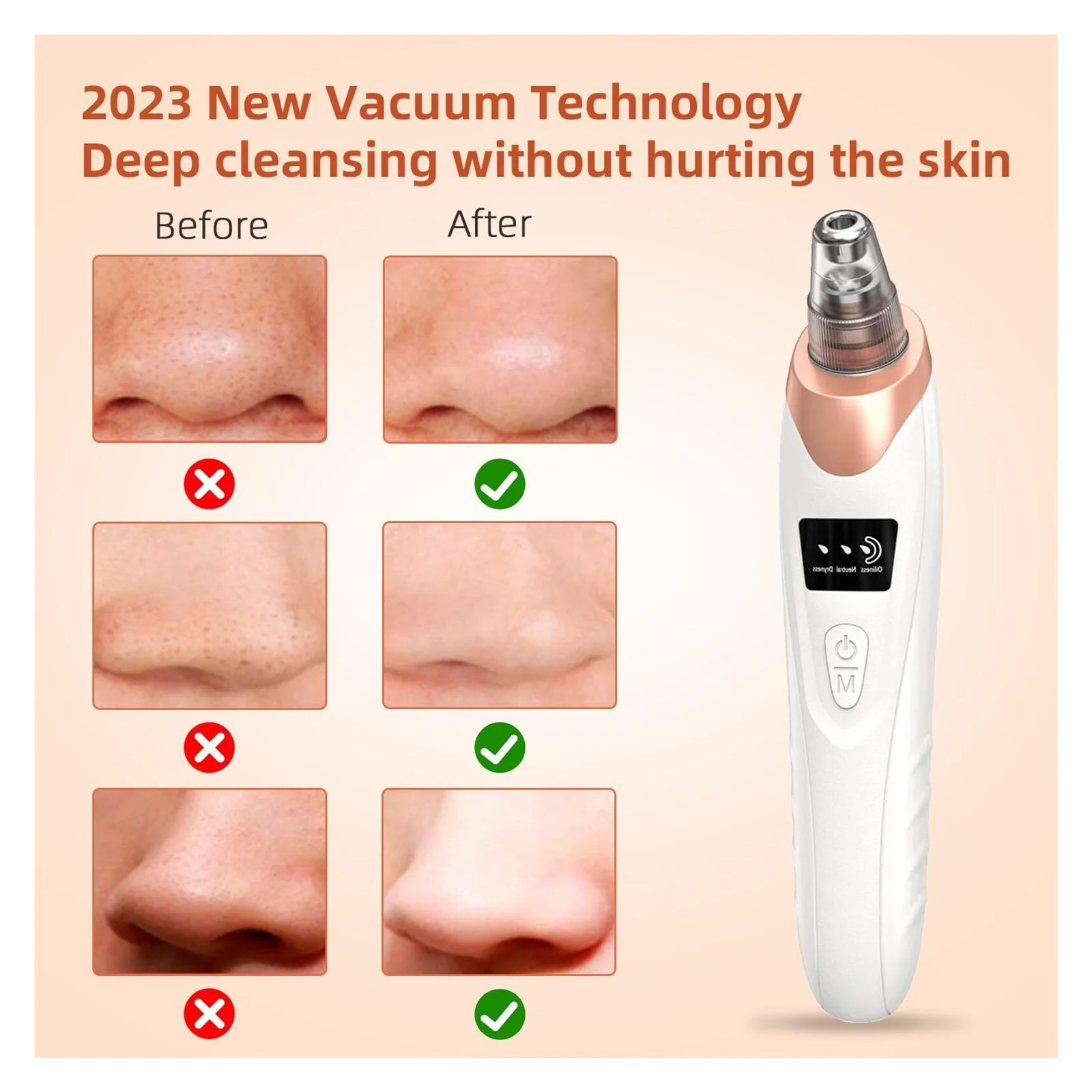 🧖♀️ USB Rechargeable Pore Vacuum Blackhead Remover