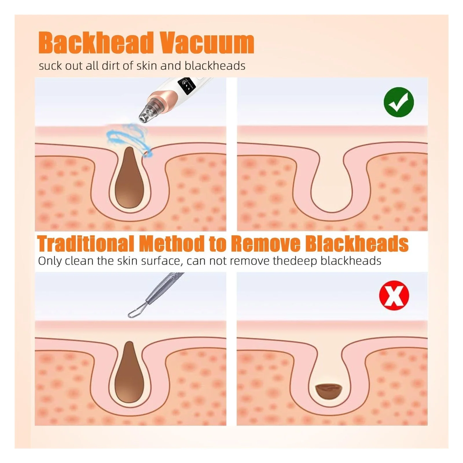 🧖♀️ USB Rechargeable Pore Vacuum Blackhead Remover