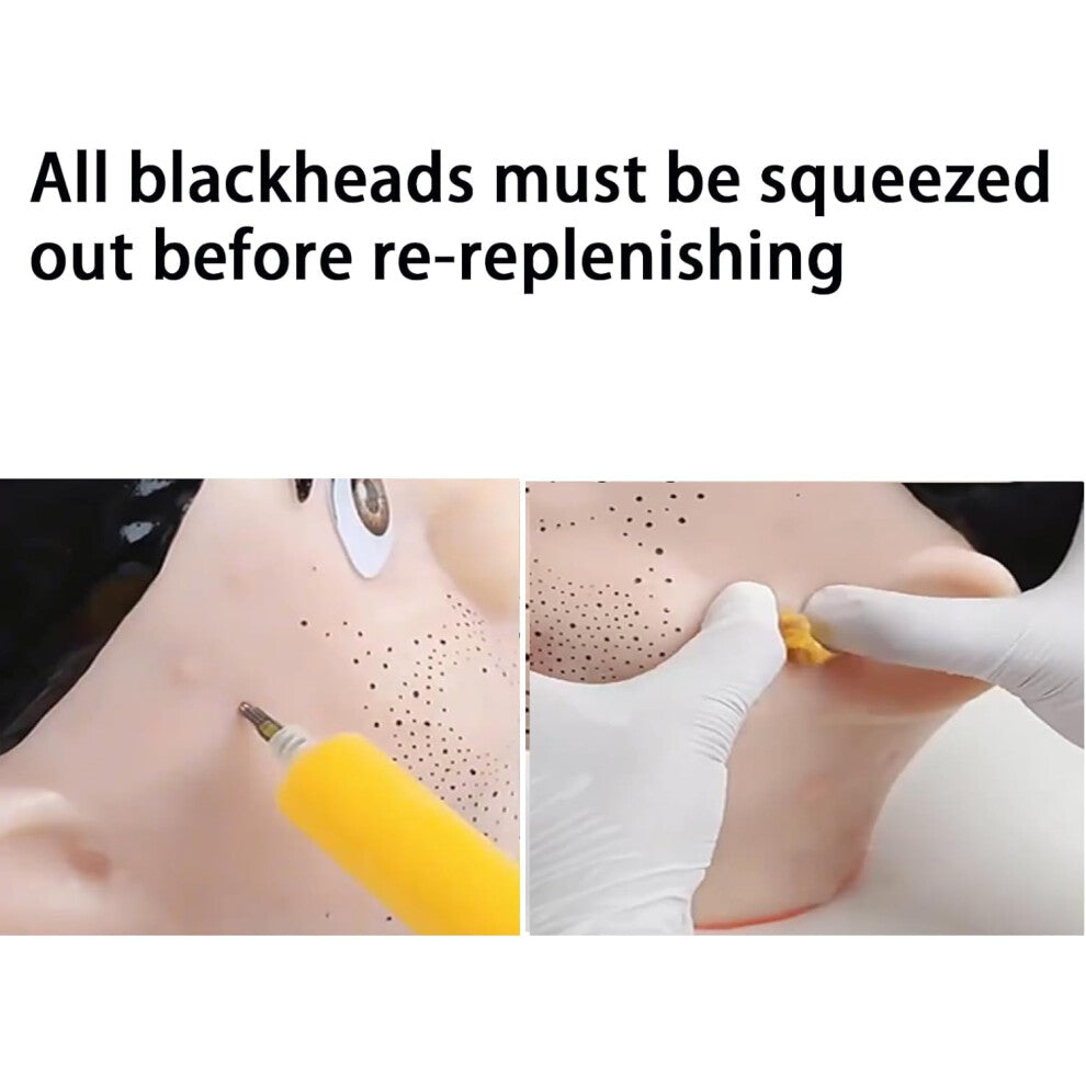 Silicone Pimple Squeezing Stress Relief Toy for Skin-Picking & Compulsive Popping Anxiety