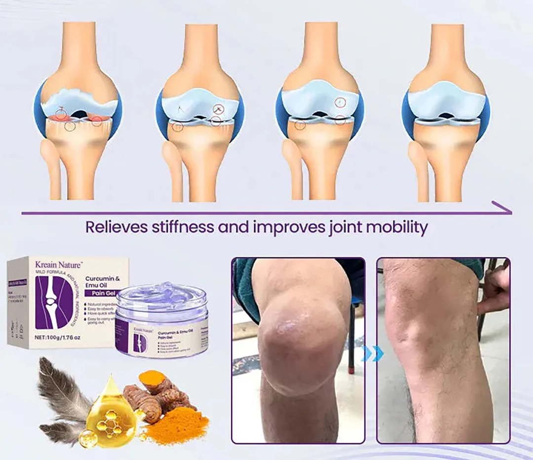🔥Limited-time discount [70% OFF] Kreain®Joint Gel