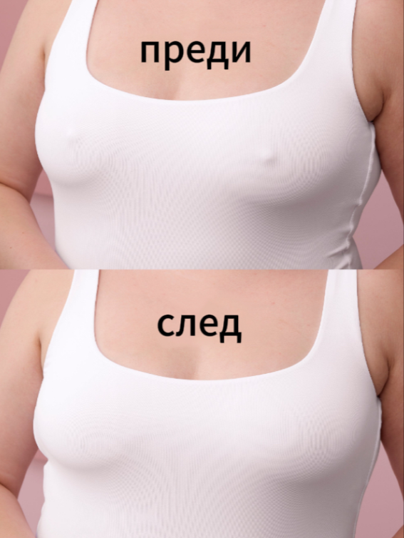 Кръгли антисклизщи брастиоли