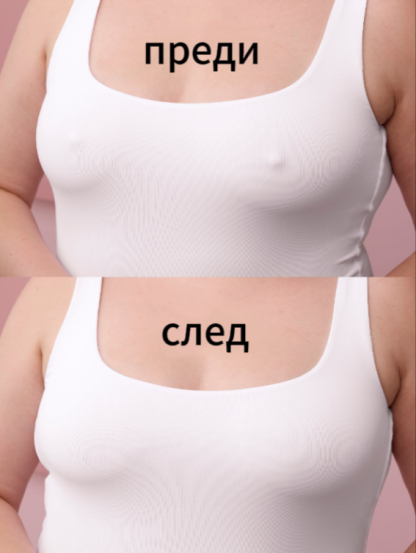 Кръгли антисклизщи брастиоли