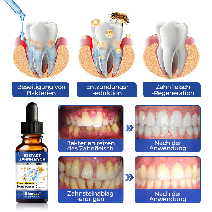 Biancat® BeeTakt Gum Repair Solution