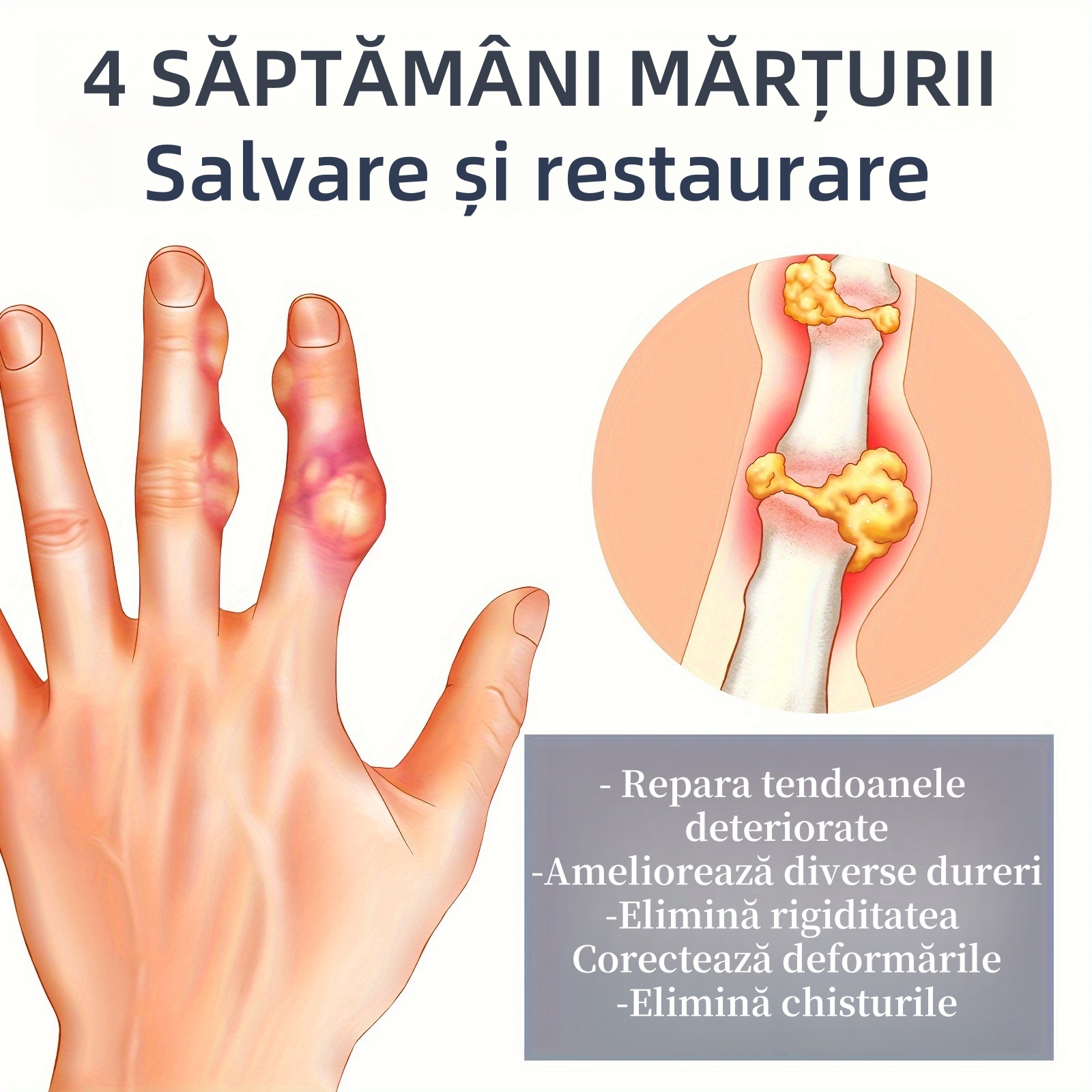 Cremă de îngrijire a articulațiilor cu venin de albine pentru mâini, picioare, ischiogambieri, genunchi, talie articulații Cremă de îngrijire pentru masaj corporal