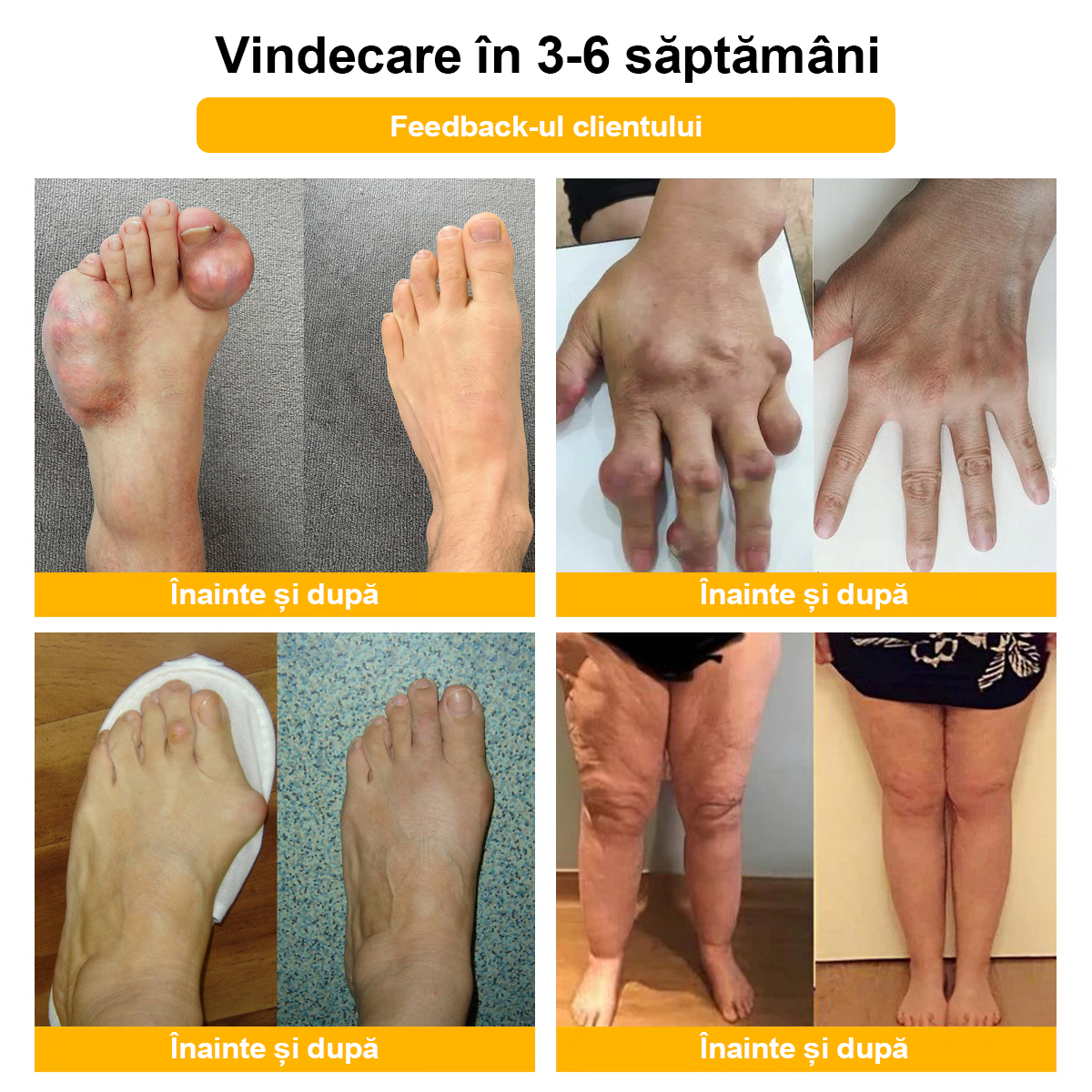 Specializat în afecțiuni ortopedice și dureri articulare 👨‍⚕️ 𝐹𝐴𝑇𝑂𝑁𝐺™ Cremă pentru artrită cu venin de albine și curcuma🧴🧴