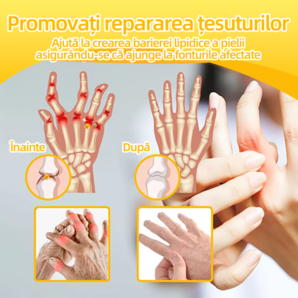 Specializat în afecțiuni ortopedice și dureri articulare 👨‍⚕️ 𝐹𝐴𝑇𝑂𝑁𝐺™ Cremă pentru artrită cu venin de albine și curcuma🧴🧴