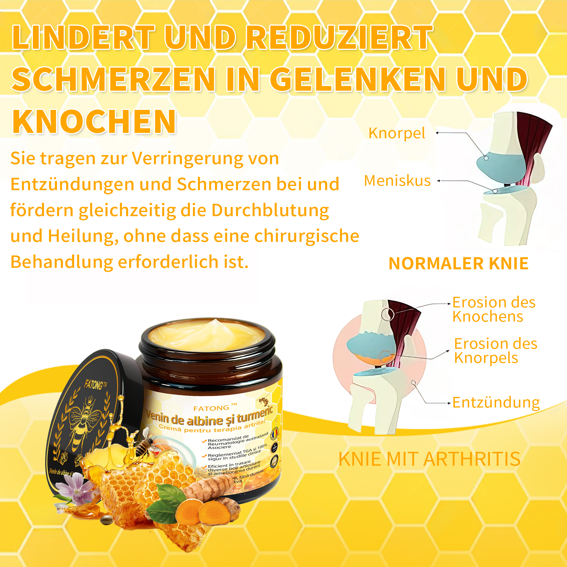 Specializat în afecțiuni ortopedice și dureri articulare 👨‍⚕️ 𝐹𝐴𝑇𝑂𝑁𝐺™ Cremă pentru artrită cu venin de albine și curcuma🧴🧴