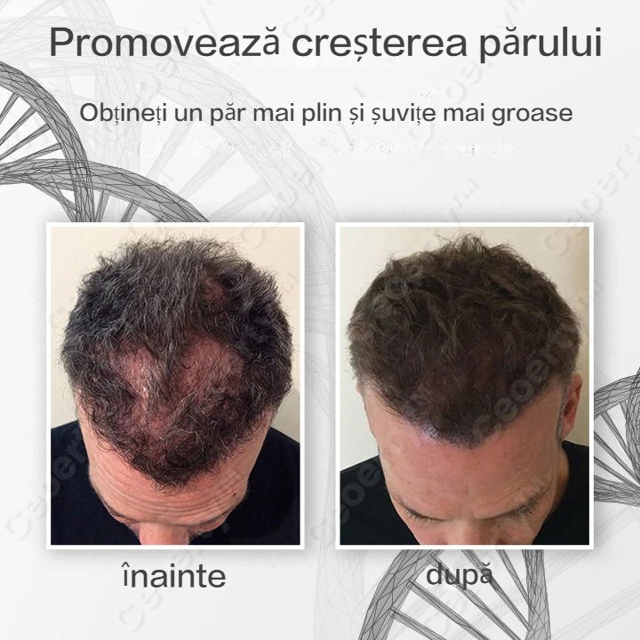 Spray de păr Ceoerty™ SheddStop Pro-Strength