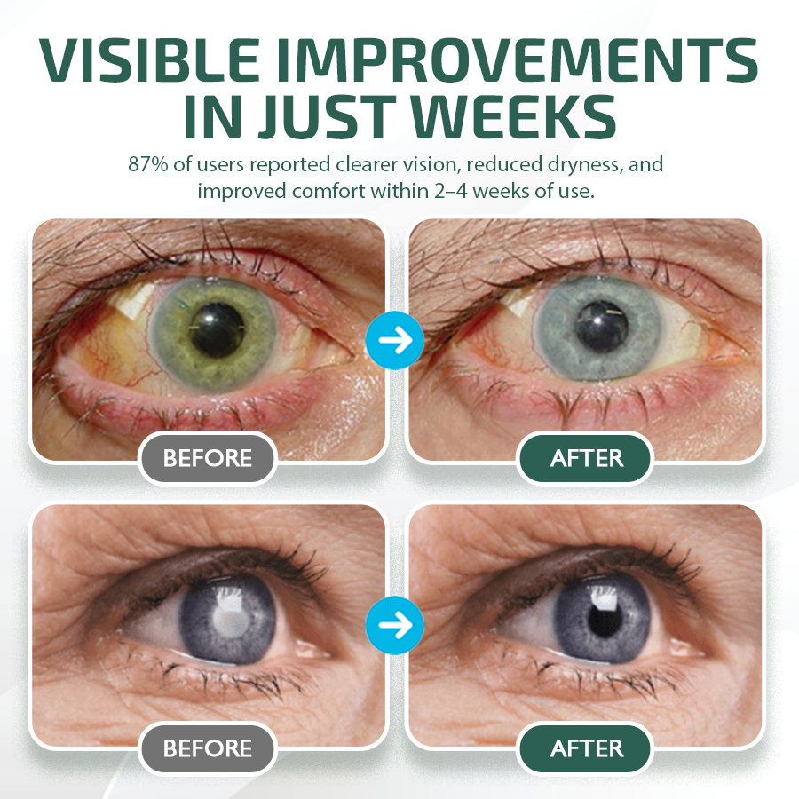 NEGUSY™ Nano Očné Kvapky Sérum 👩‍⚕️ Odporúčané Kráľovskou kolegiou oftalmológov (Vhodné pre presbyopiu, syndróm suchého oka, glaukóm a kataraktu)