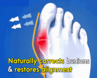 1591263795497532.gif 20200305_Bunion_Corrector_GIFSC2_480x480.gif
