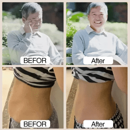 Acuplus+ Sugar Control Acupressure Point Clip - Buy 1 Get 1 FREE ( HomepicksOfficial )🔥