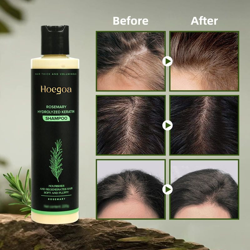 🔥Limited-time discount of 50%🔥Hoegoa Rosemary Shampoo🌿