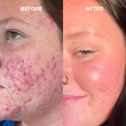 Viareline Matcha Purifying Clay Mask