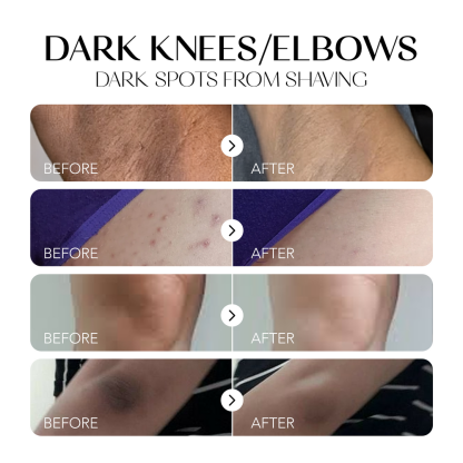 Dark Spot Corrector