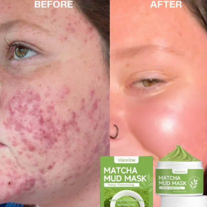 Viareline Matcha Purifying Clay Mask
