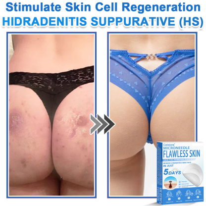 🏆2-in-1 Microneedle & Hydrocolloid Patch | Raised Moles,Acne,  Flat Warts & Skin Tags Remover | Improves Wrinkles, Scars & Blemishes | Invisible Pimple Patches for Face & Body
