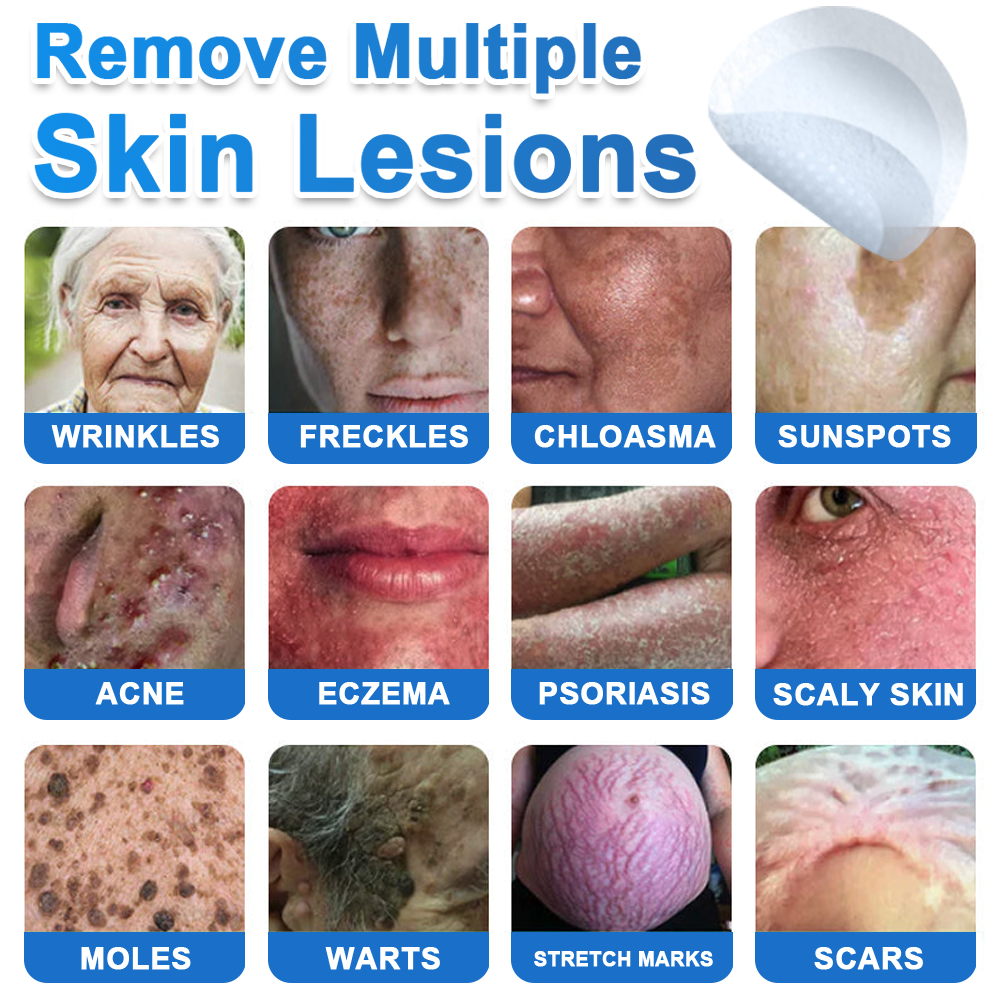 🏆2-in-1 Microneedle & Hydrocolloid Patch | Raised Moles,Acne,  Flat Warts & Skin Tags Remover | Improves Wrinkles, Scars & Blemishes | Invisible Pimple Patches for Face & Body