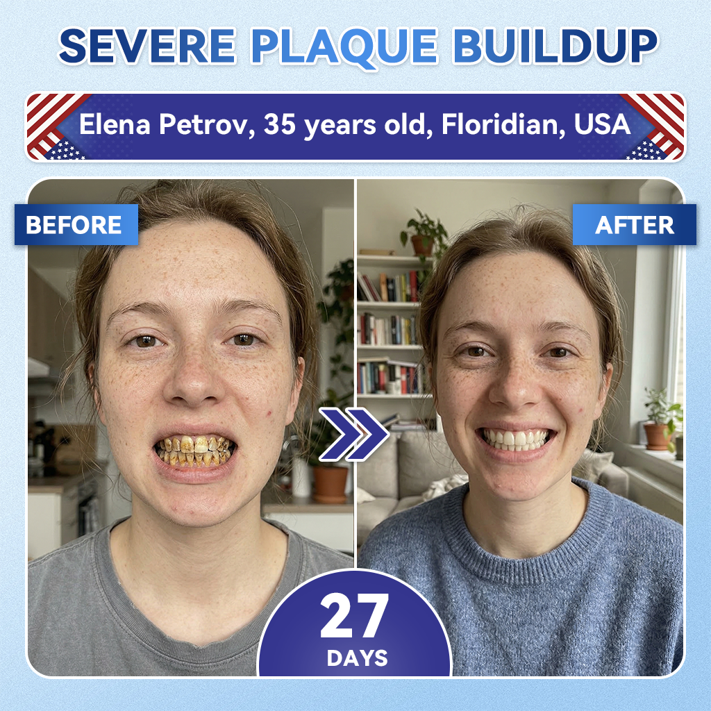 Your Smile~ SmileFitPro® 🦷 Tideglusib Fast‑Dissolving Tooth & Gum Repair Oral Strips ✨ (𝟓-𝐢𝐧-𝟏 💎 𝐑𝐞𝐛𝐮𝐢𝐥𝐝 𝐄𝐧𝐚𝐦𝐞𝐥 & 𝐃𝐞𝐧𝐭𝐢𝐧 • 𝐒𝐭𝐫𝐞𝐧𝐠𝐭𝐡𝐞𝐧 𝐆𝐮𝐦𝐬 • 𝐄𝐫𝐚𝐝𝐢𝐜𝐚𝐭𝐞 𝐓𝐚𝐫𝐭𝐚𝐫 & 𝐎𝐝𝐨𝐫 • 𝐖𝐡𝐢𝐭𝐞𝐧𝐢𝐧𝐠 • 𝐒𝐭𝐨𝐩 𝐓𝐨𝐨𝐭𝐡 𝐒𝐞𝐧𝐬𝐢𝐭𝐢𝐯𝐢𝐭𝐲)