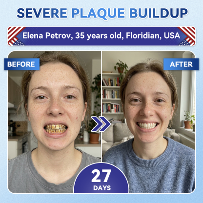 Your Smile~ SmileFitPro® 🦷 Tideglusib Fast‑Dissolving Tooth & Gum Repair Oral Strips ✨ (𝟓-𝐢𝐧-𝟏 💎 𝐑𝐞𝐛𝐮𝐢𝐥𝐝 𝐄𝐧𝐚𝐦𝐞𝐥 & 𝐃𝐞𝐧𝐭𝐢𝐧 • 𝐒𝐭𝐫𝐞𝐧𝐠𝐭𝐡𝐞𝐧 𝐆𝐮𝐦𝐬 • 𝐄𝐫𝐚𝐝𝐢𝐜𝐚𝐭𝐞 𝐓𝐚𝐫𝐭𝐚𝐫 & 𝐎𝐝𝐨𝐫 • 𝐖𝐡𝐢𝐭𝐞𝐧𝐢𝐧𝐠 • 𝐒𝐭𝐨𝐩 𝐓𝐨𝐨𝐭𝐡 𝐒𝐞𝐧𝐬𝐢𝐭𝐢𝐯𝐢𝐭𝐲)