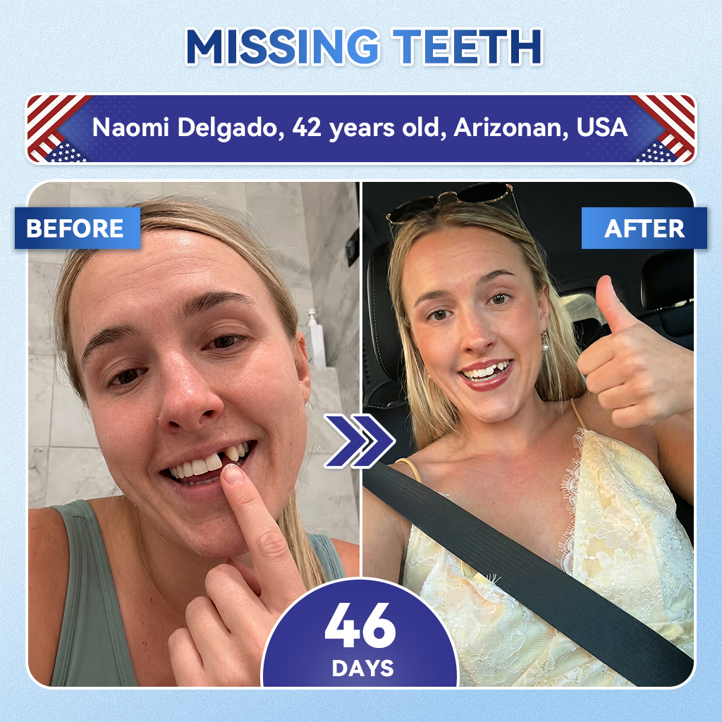 Your Smile~ SmileFitPro® 🦷 Tideglusib Fast‑Dissolving Tooth & Gum Repair Oral Strips ✨ (𝟓-𝐢𝐧-𝟏 💎 𝐑𝐞𝐛𝐮𝐢𝐥𝐝 𝐄𝐧𝐚𝐦𝐞𝐥 & 𝐃𝐞𝐧𝐭𝐢𝐧 • 𝐒𝐭𝐫𝐞𝐧𝐠𝐭𝐡𝐞𝐧 𝐆𝐮𝐦𝐬 • 𝐄𝐫𝐚𝐝𝐢𝐜𝐚𝐭𝐞 𝐓𝐚𝐫𝐭𝐚𝐫 & 𝐎𝐝𝐨𝐫 • 𝐖𝐡𝐢𝐭𝐞𝐧𝐢𝐧𝐠 • 𝐒𝐭𝐨𝐩 𝐓𝐨𝐨𝐭𝐡 𝐒𝐞𝐧𝐬𝐢𝐭𝐢𝐯𝐢𝐭𝐲)