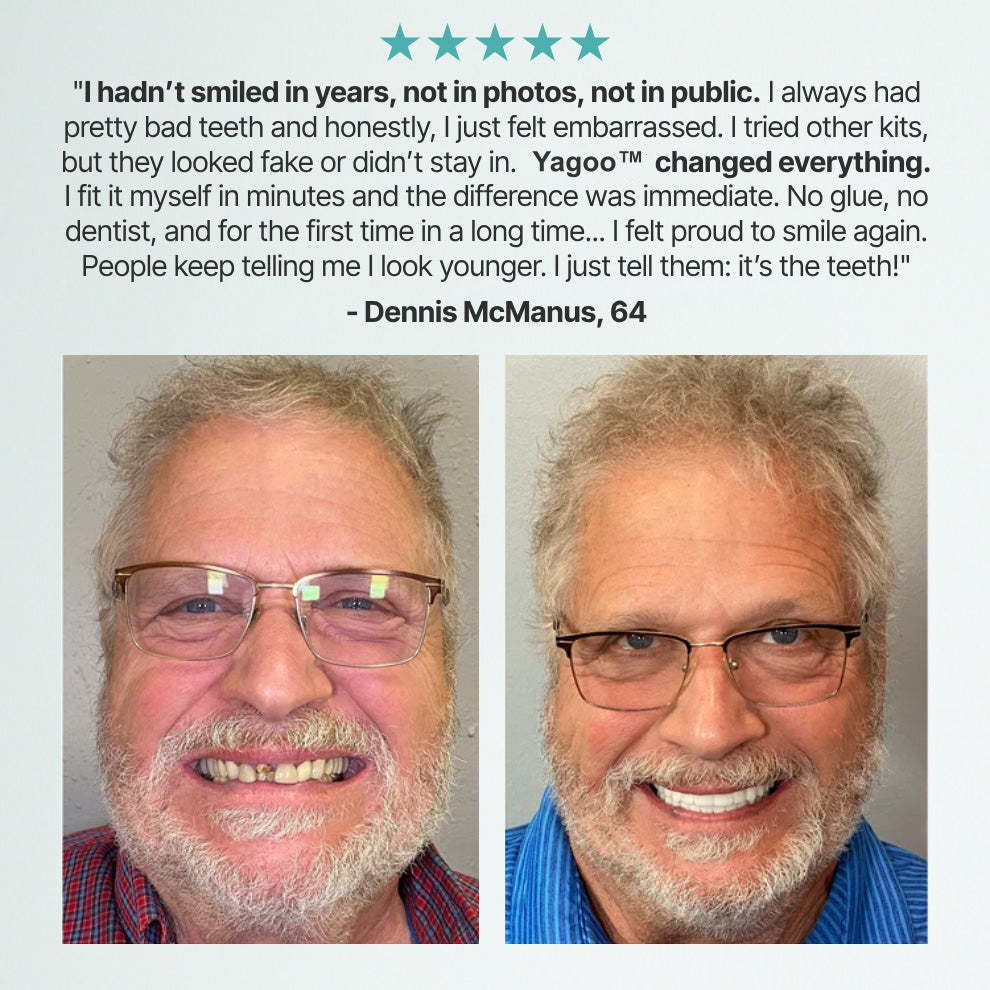 🎅CHRISTMAS HOT SALE-🏆Ends Today: 70% OFF! Yagoo™ Custom Custom-Fit Full Functional Dentures