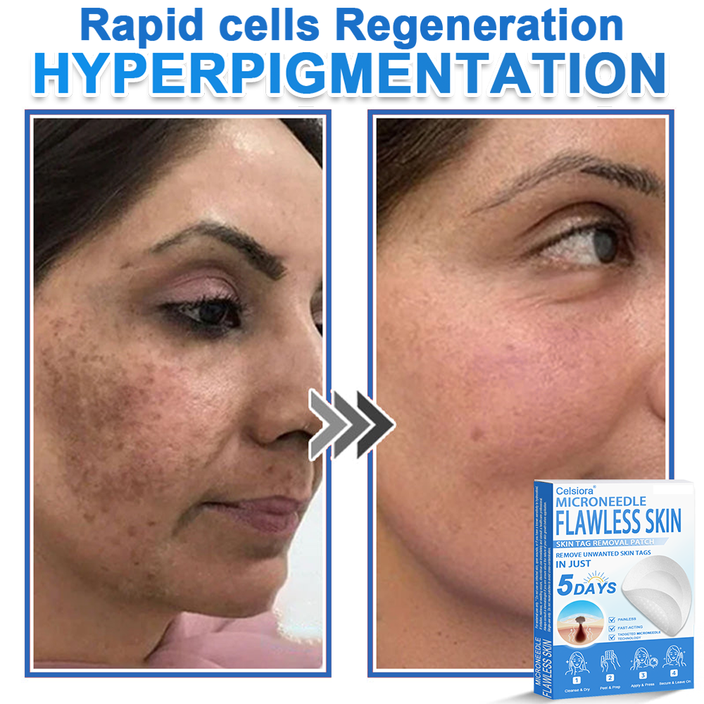 🏆2-in-1 Microneedle & Hydrocolloid Patch | Raised Moles,Acne,  Flat Warts & Skin Tags Remover | Improves Wrinkles, Scars & Blemishes | Invisible Pimple Patches for Face & Body