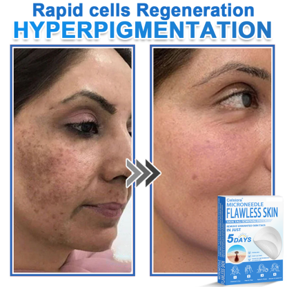 🏆2-in-1 Microneedle & Hydrocolloid Patch | Raised Moles,Acne,  Flat Warts & Skin Tags Remover | Improves Wrinkles, Scars & Blemishes | Invisible Pimple Patches for Face & Body