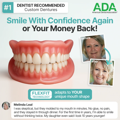 ✨Ends Today: 70% OFF! Tiworld™⏰ Custom-Fit Full Functional Dentures Make you more confident