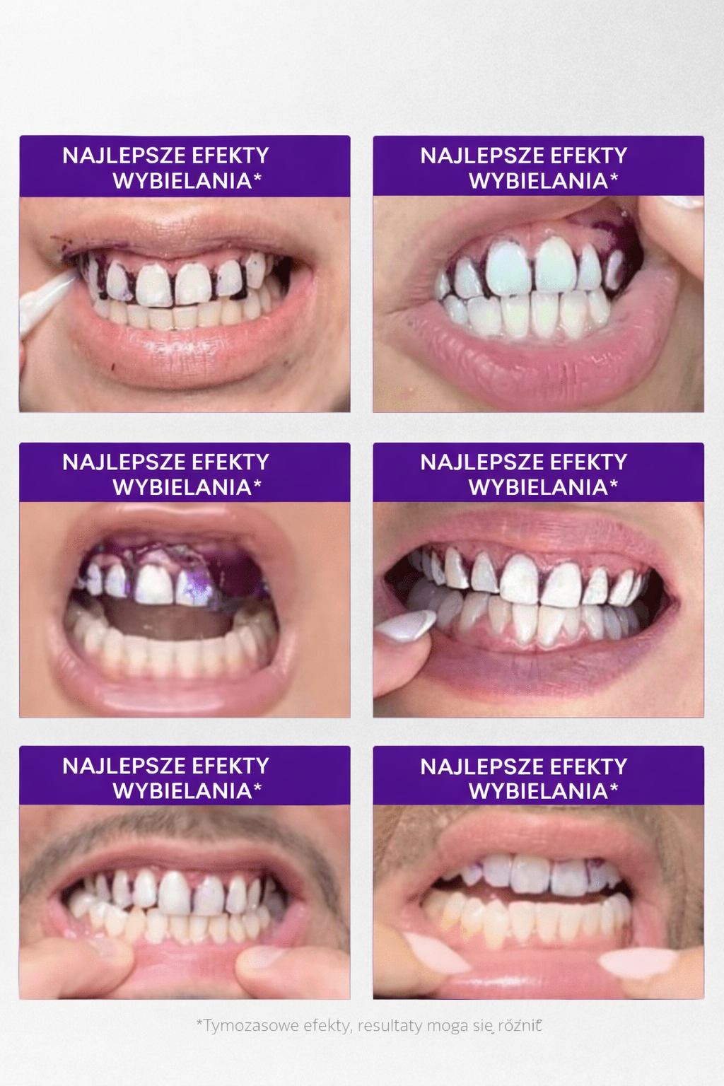 Paski wybielające V34