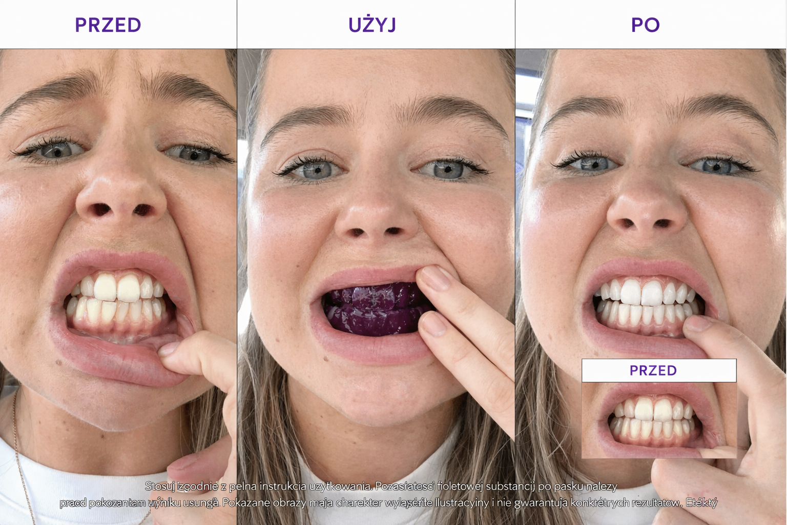 Paski wybielające V34