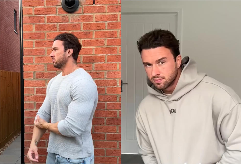 How I Went From Nearly Depressed Over Hair Loss to Getting My Life Back in 3 Months-dayperk