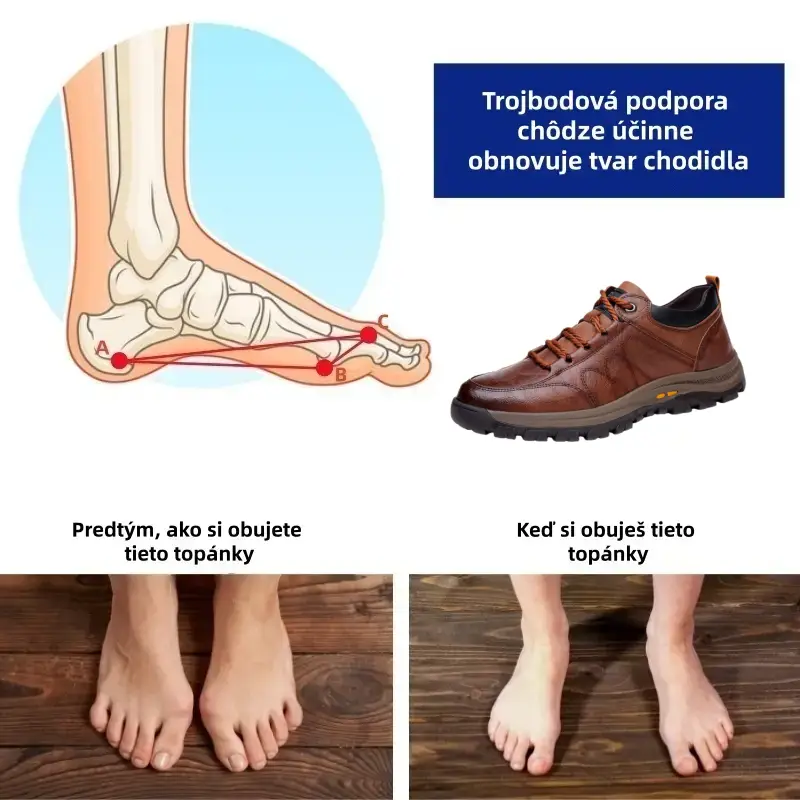 🔴 Talianske ručne šité topánky z pravej kože ✅ Elegantné ortopedické topánky + podpora členku 🦶 Pohodlné a protišmykové (vhodné pre ľudí s problémami s nohami!)