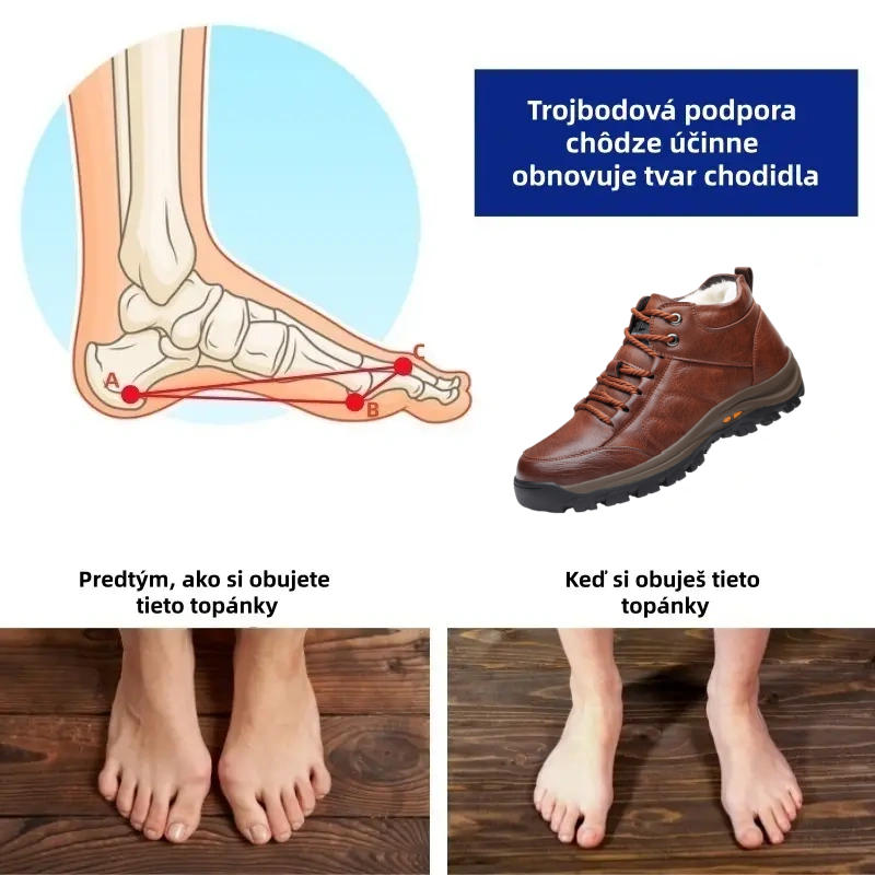 🔴 Talianske ručne šité topánky z pravej kože ✅ Elegantné ortopedické topánky + podpora členku 🦶 Pohodlné a protišmykové (vhodné pre ľudí s problémami s nohami!)