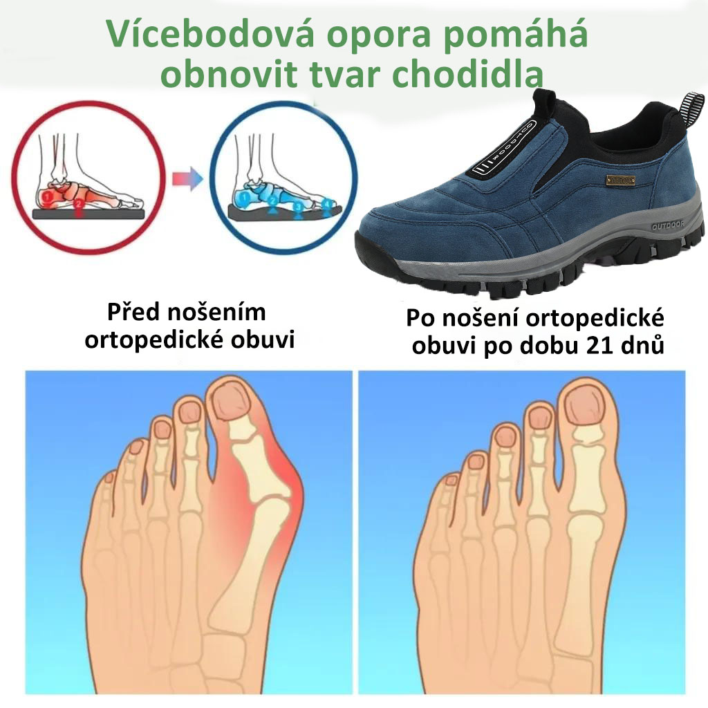 ✅Vysoce kvalitní semišové boty🦶Ulevují od bolesti nohou a fasciitidy - Voděodolné a protiskluzové🔴Ručně vyráběné ortopedické boty