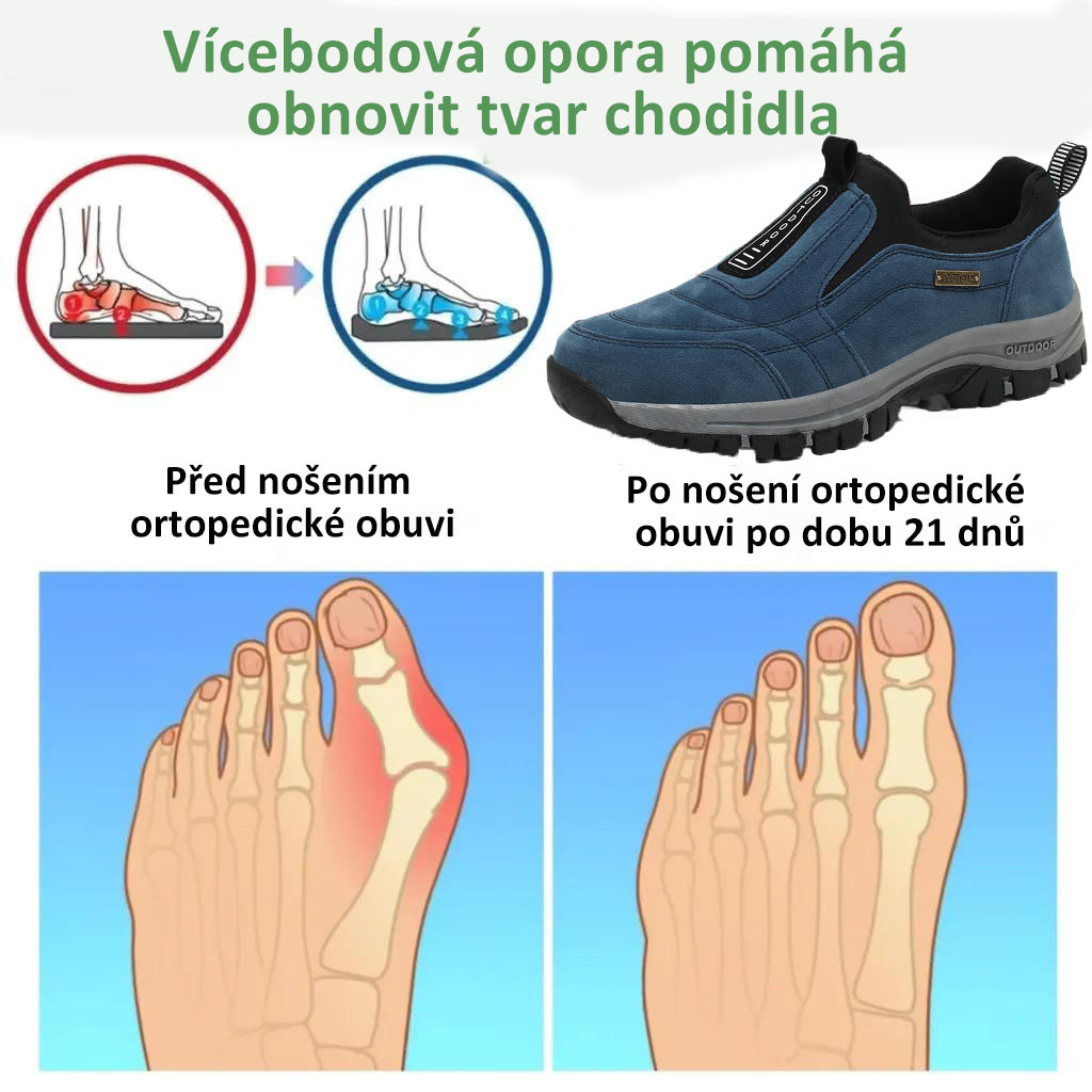 ✅Vysoce kvalitní semišové boty🦶Ulevují od bolesti nohou a fasciitidy - Voděodolné a protiskluzové🔴Ortopedické boty