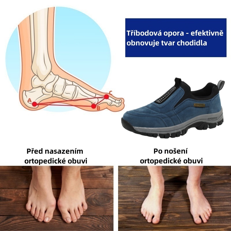 Sennery® – Ergonomicky navržená lékařská ortopedická obuv, která ulevuje od bolesti zad, kloubů a nohou.