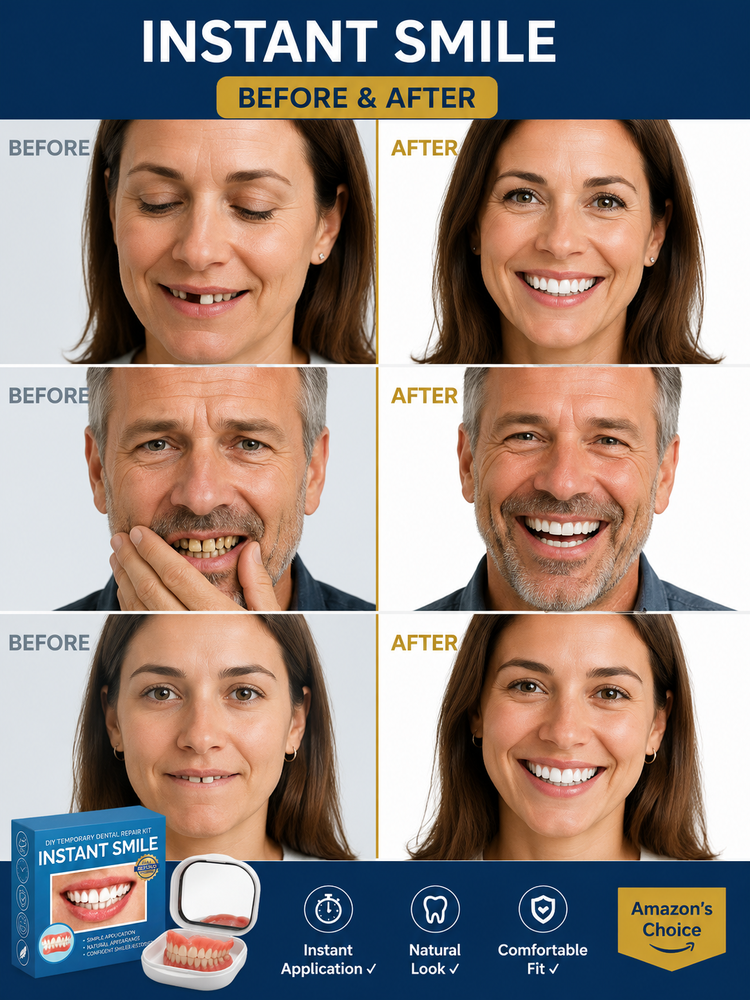Instant Smile Dentures