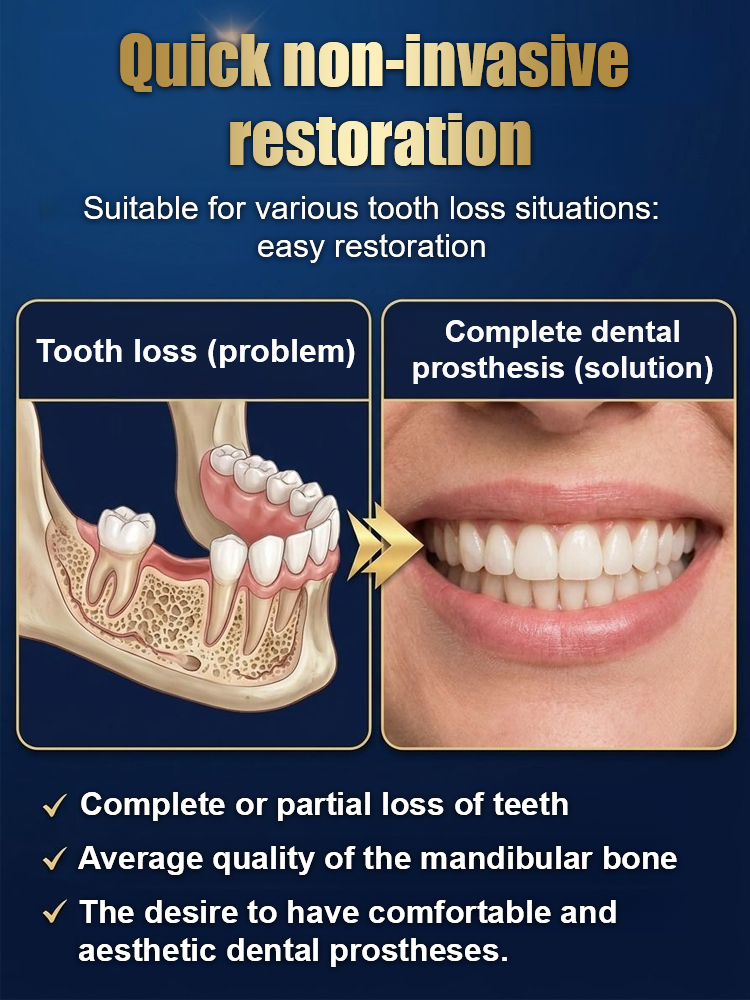 Strong Suction Full Denture for Confident Smile