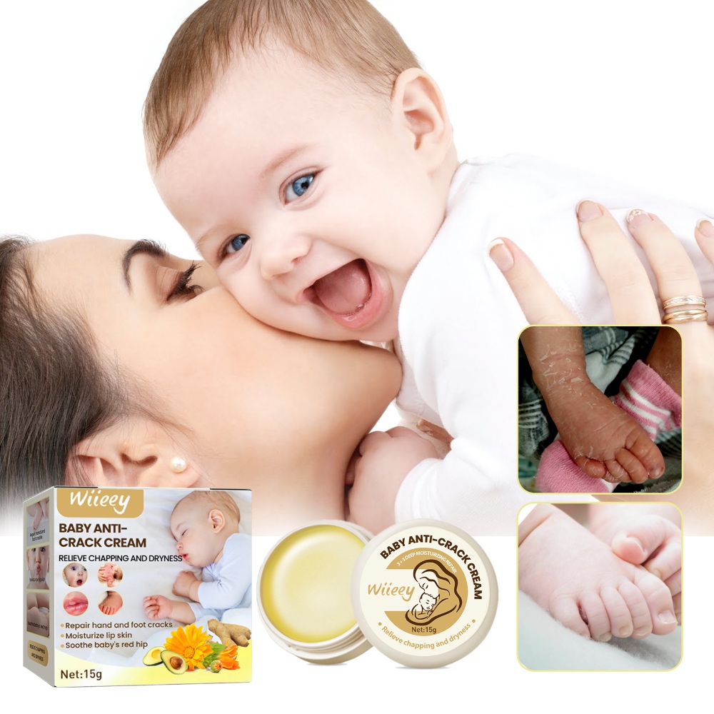 Wiieey Baby Anti-Crack Cream – Moisturizing & Hydrating Cream for Hands, Feet & Body