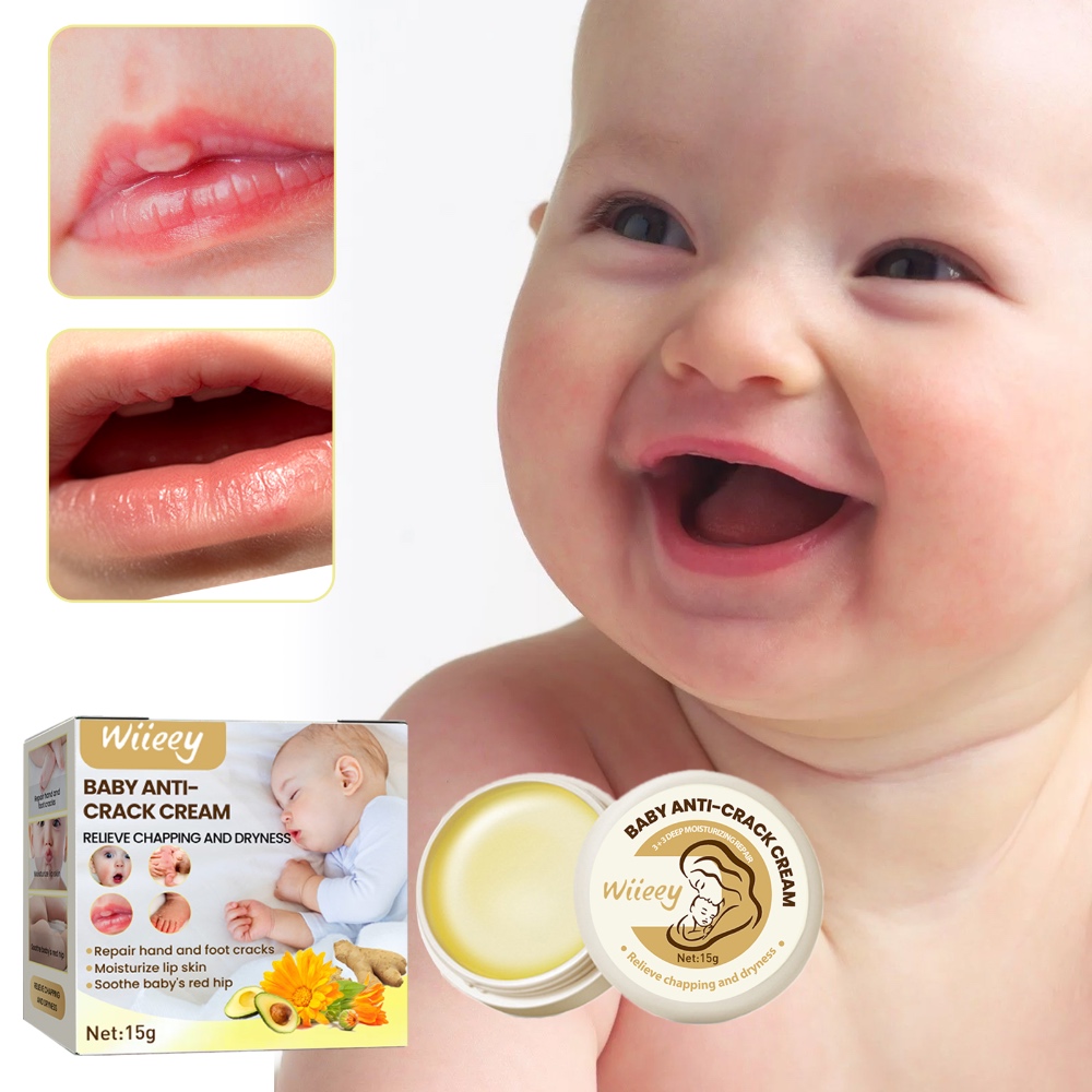 Wiieey Baby Anti-Crack Cream – Moisturizing & Hydrating Cream for Hands, Feet & Body