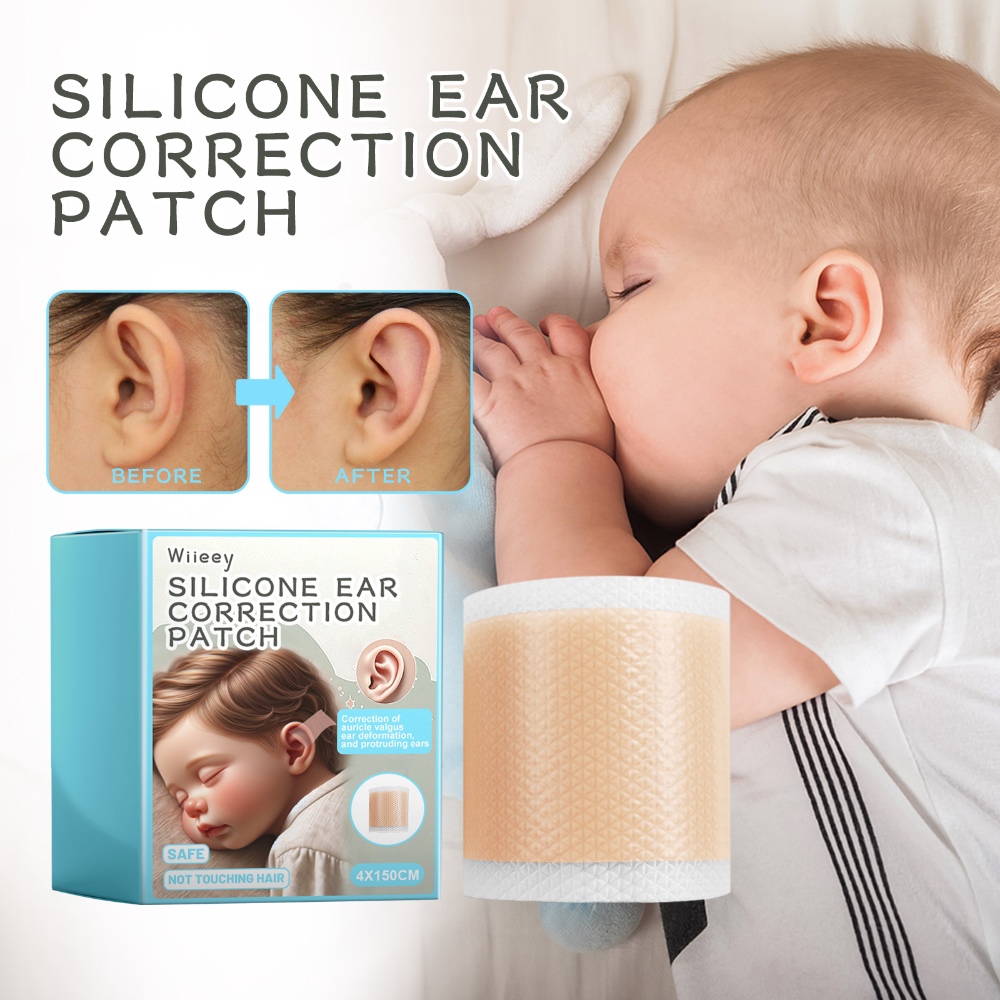 Wiieey Silicone Ear Corrector Pads – Gentle, Waterproof & Breathable for Children’s Prominent Ears