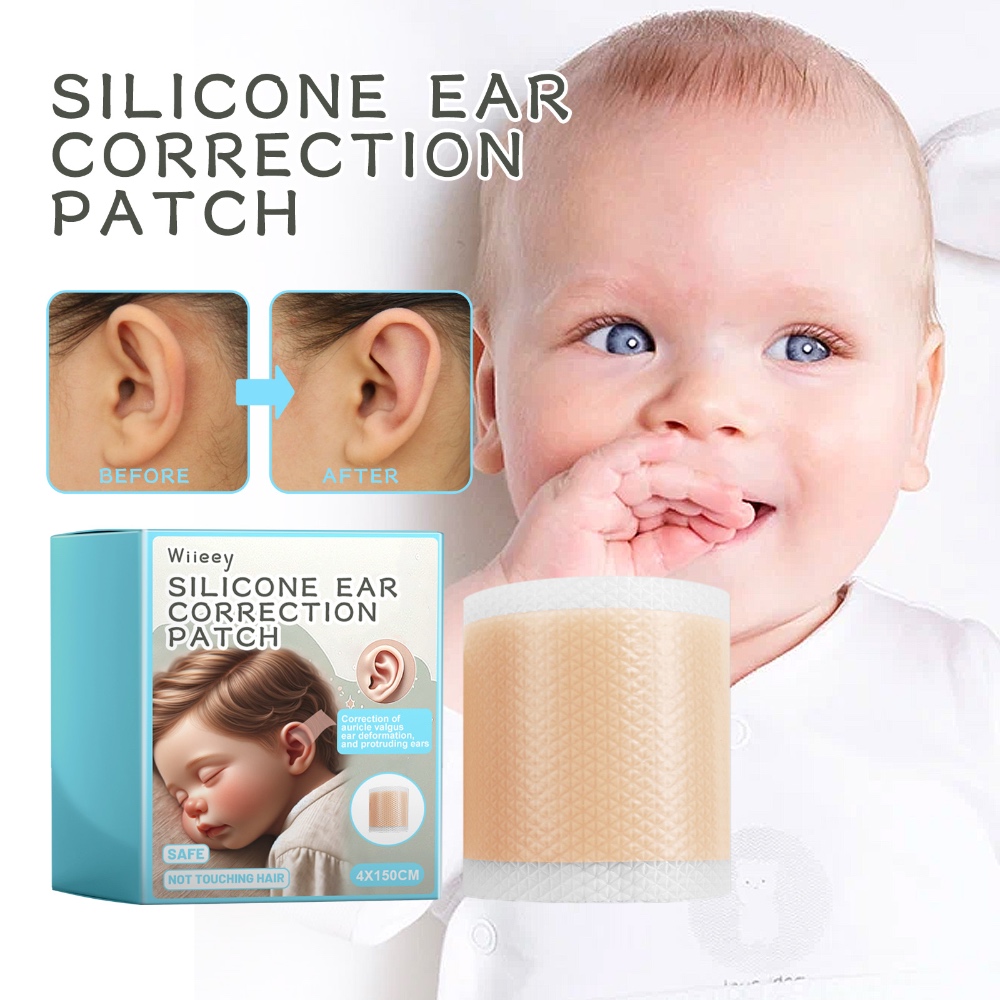 Wiieey Silicone Ear Corrector Pads – Gentle, Waterproof & Breathable for Children’s Prominent Ears