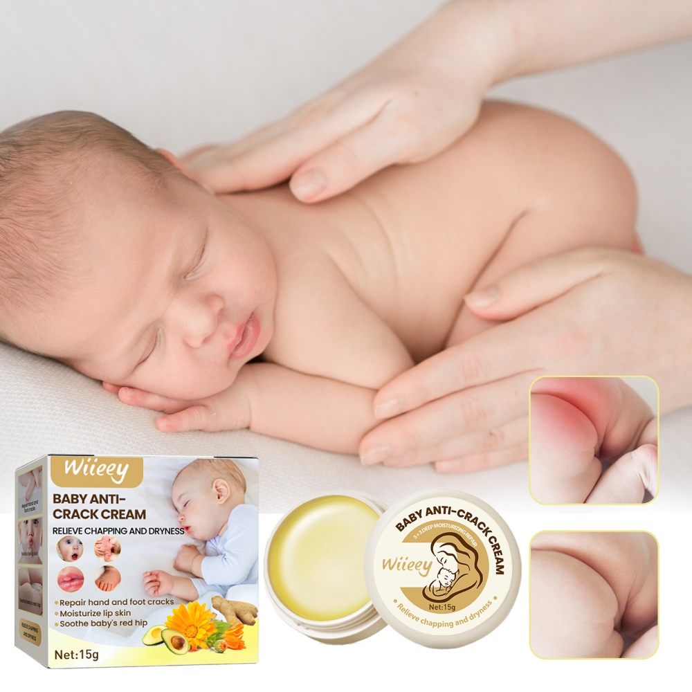 Wiieey Baby Anti-Crack Cream – Moisturizing & Hydrating Cream for Hands, Feet & Body