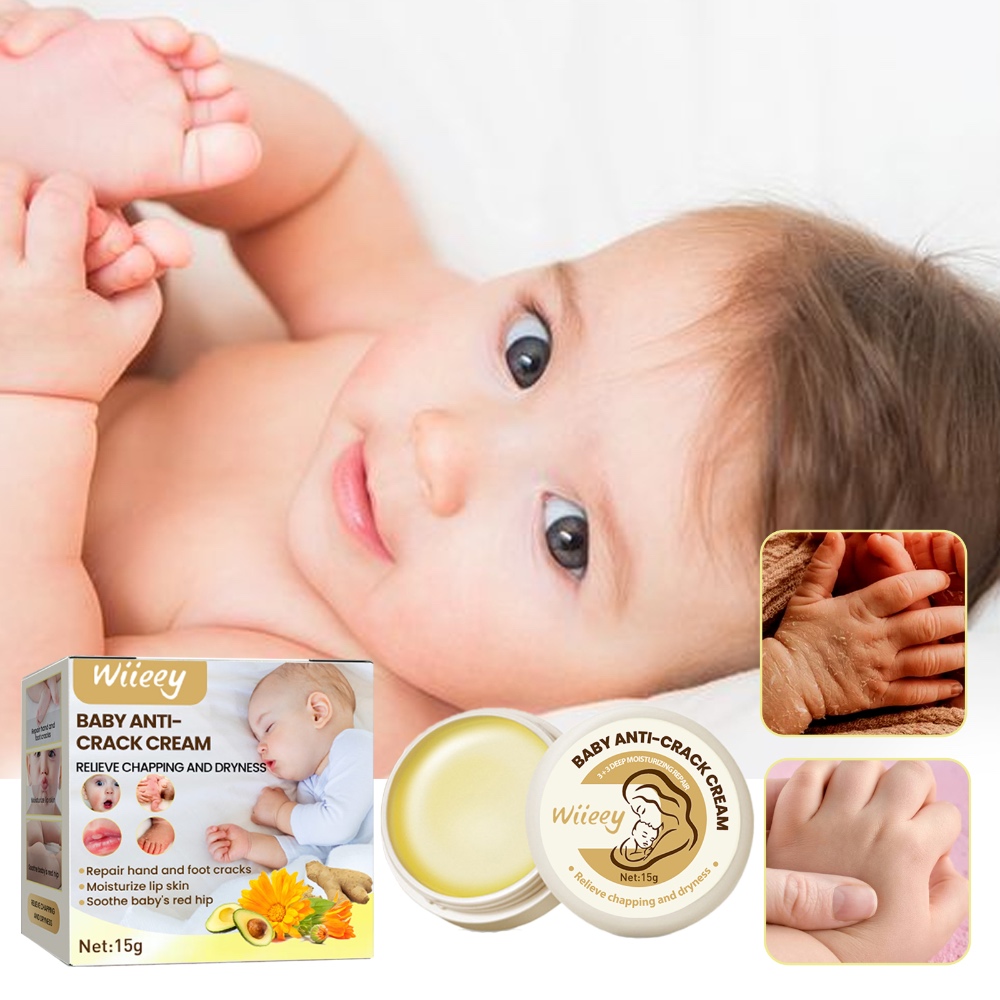 Wiieey Baby Anti-Crack Cream – Moisturizing & Hydrating Cream for Hands, Feet & Body