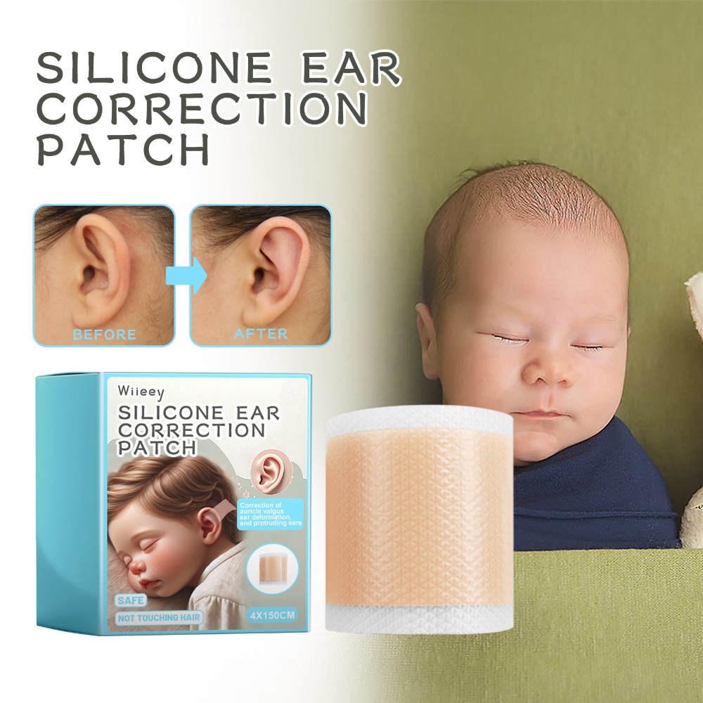 Wiieey Silicone Ear Corrector Pads – Gentle, Waterproof & Breathable for Children’s Prominent Ears
