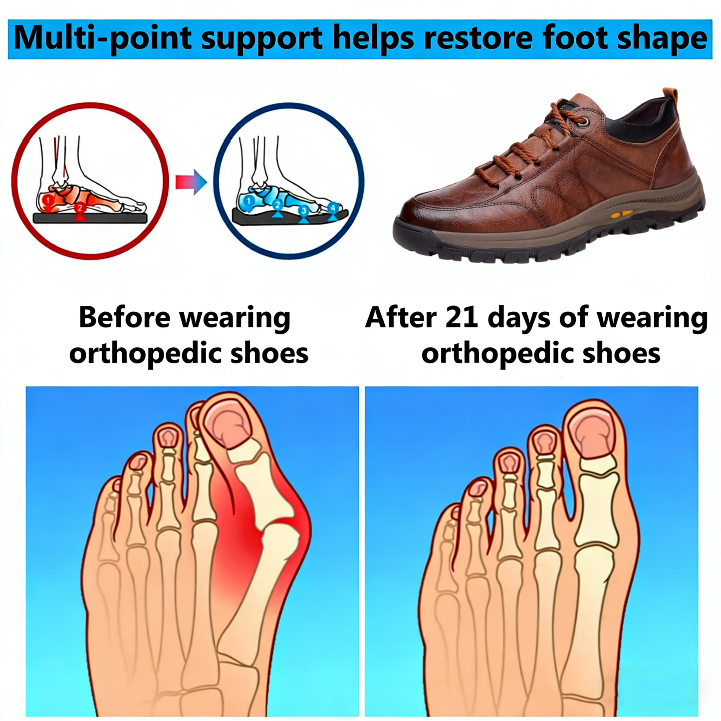 【⏰Limited time offer: 70% off – Don't miss it!】Ergonomic orthopedic shoes – ✅️Corrects posture while walking and relieves foot pain – Newly improved waterproof and anti-slip 👞Selected Australian leather