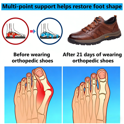 【⏰Limited time offer: 70% off – Don't miss it!】Ergonomic orthopedic shoes – ✅️Corrects posture while walking and relieves foot pain – Newly improved waterproof and anti-slip 👞Selected Australian leather