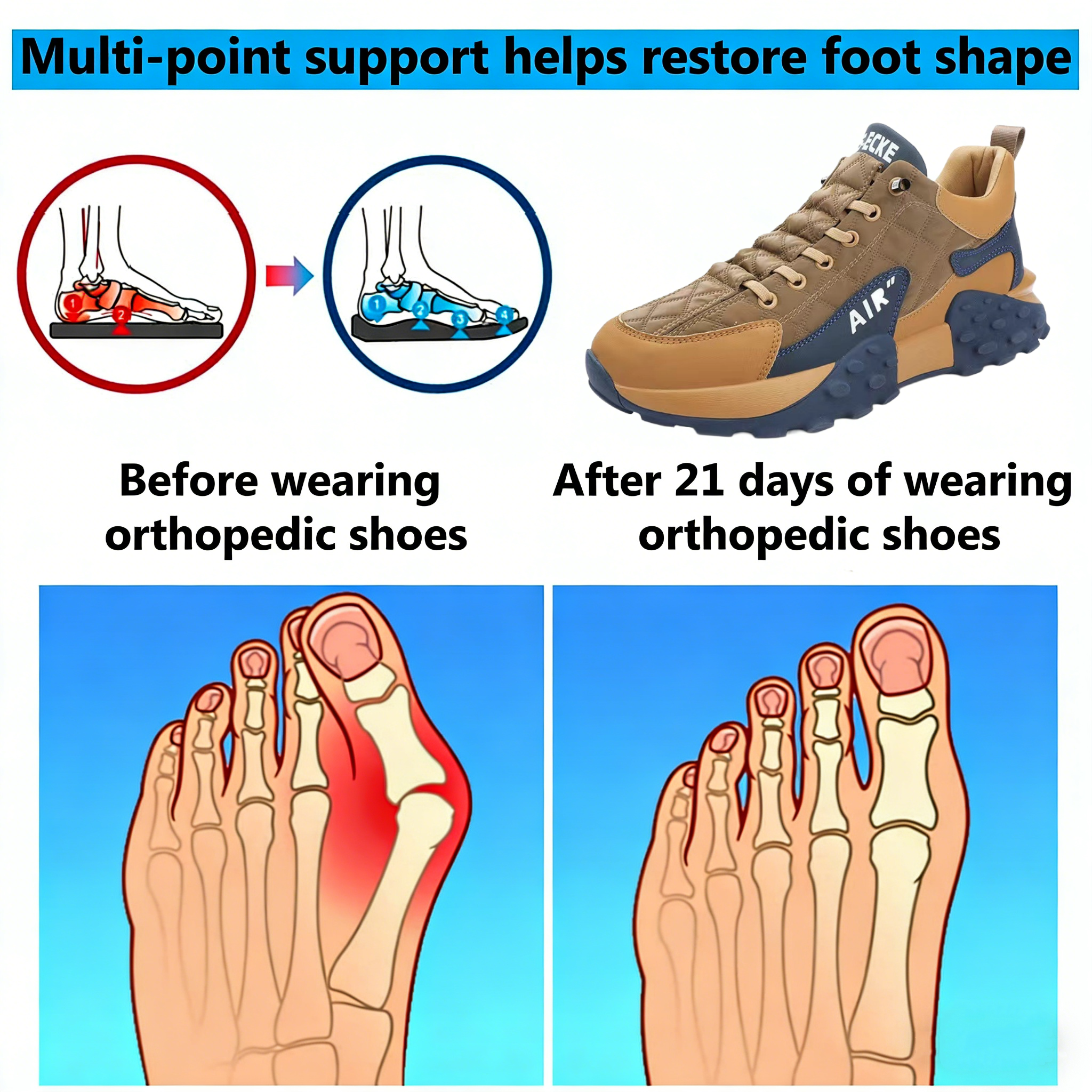 【⏰Limited Time 50% Off - Don't Miss It】Ergonomic Orthopedic Shoes - ✅️ Posture Correction While Walking - Waterproof and Anti-Slip 👞 Selected Australian Leather